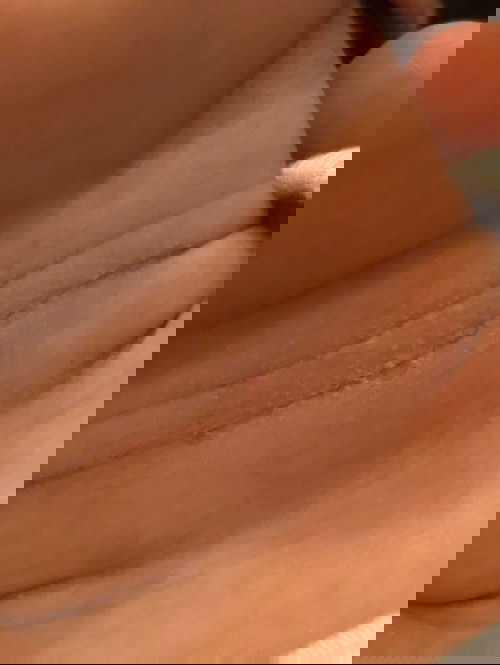 ขอคำแนะนำค่ะ ลูกสาวคออับชื้น