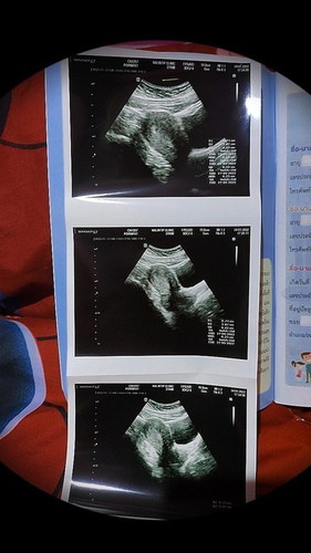 สอบถามทีค่ะแม่ๆ