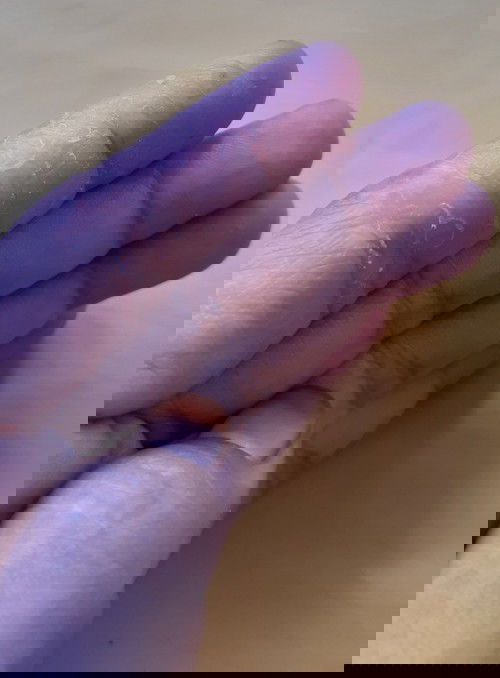 Kmrin sblum hamil tanganku g prnah sprti itu,skrng smnjak hamil tnganku jadi sprti itu knpa ya bund?