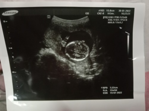 อัลตร้าซาวด์ 15w