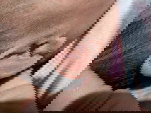 Namamalat skin ni baby, normal po ba ito?