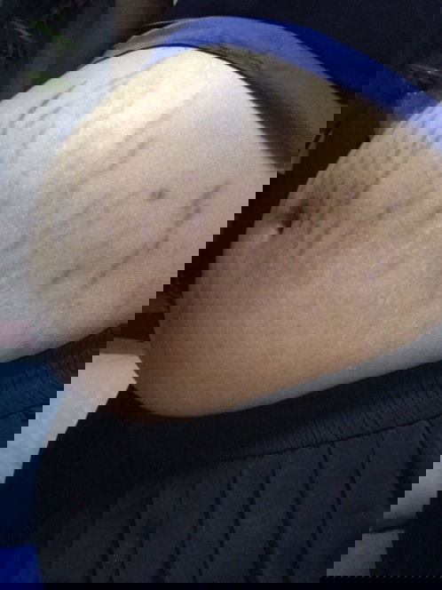 ครีมอะไรก็เอาไม่อยู่แล้วจังหวะนี้