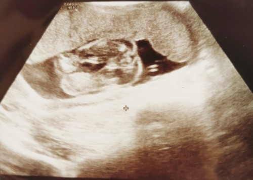 22Week Jantina