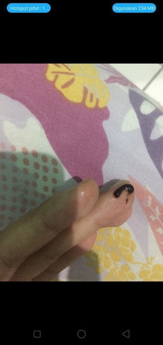 Flek Di kehamilan 6 Minggu