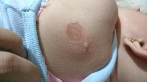 ada yg tau ini penyakit apa bunda