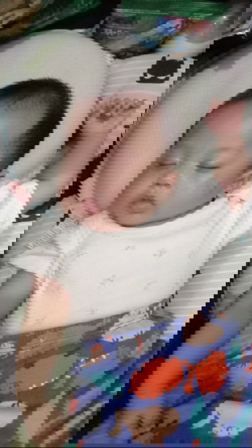 Flek coklat pada bayi