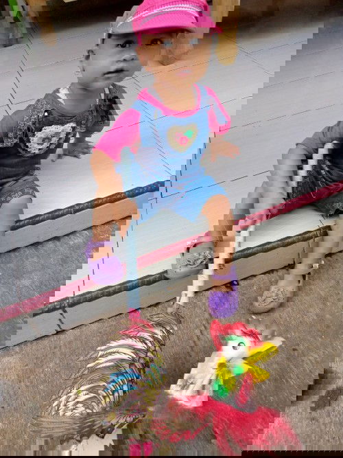 Kaki anak saya tidak lurus bengkok