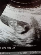 Post reply image