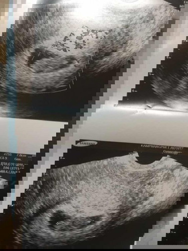 น้อง 9 w 2 d