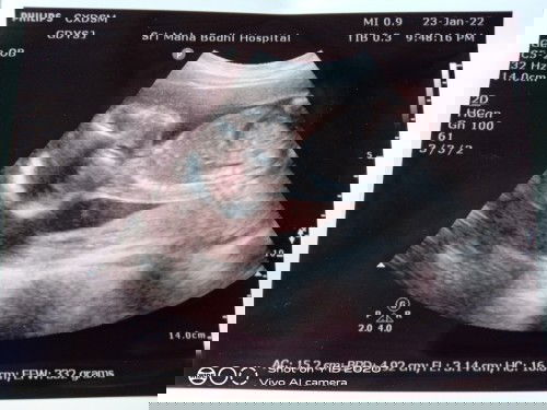 ขอดูวิธีตั้งชื่อลูกหน่อยค่ะ