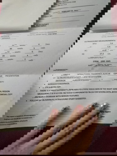 right adnexal cyst