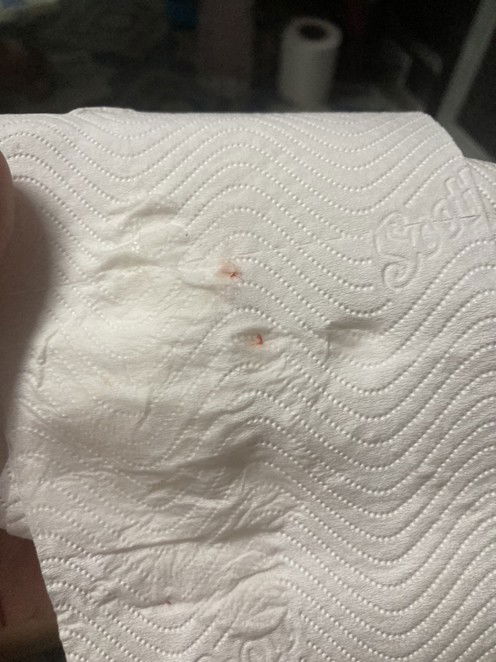 สอบถามแม่ๆค่ะ