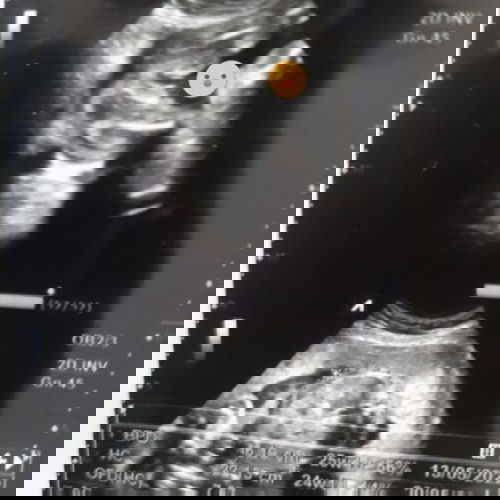 Ada yang tau ga hasil usg aku jek nya cewe/cowo