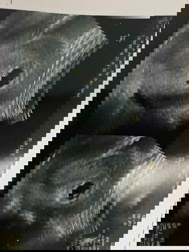 Hasil USG ada yg serupa kah bun?