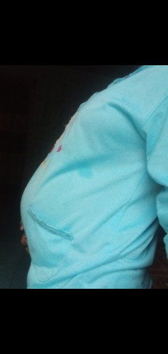 Hamil 8 bulan tapi perut masih kecil gimana y cara bikin perut lebih besar dari sebelumnya sarannya