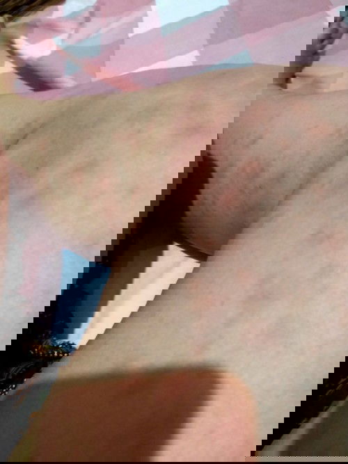 Bun mau tanya ini saya hamil anak pertama UK 32 mgg.saya gatal2 padahal gak makan aneh2.ini knp ya?