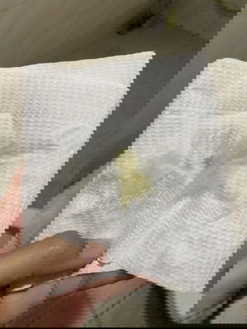 มูกเหนียวข้น สีเหลือง