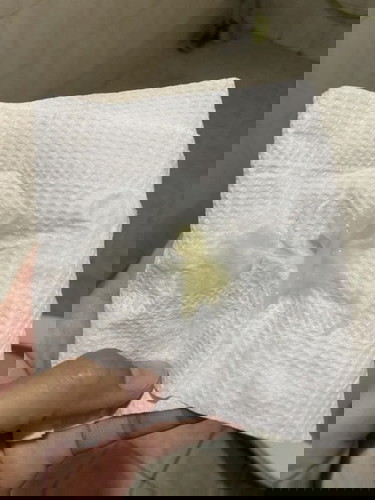 มูกเหนียวข้น สีเหลือง