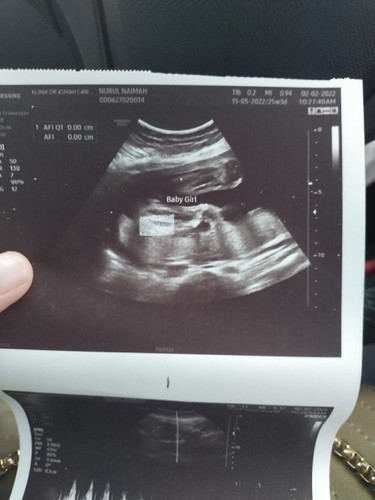 Scan gender