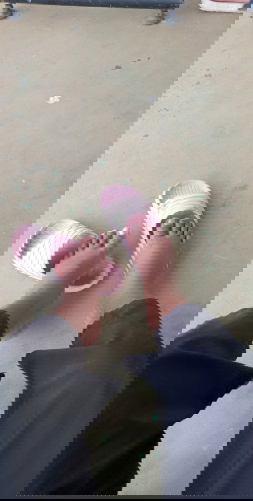 32วีคแล้วเท้าบวม