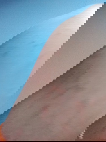 Cetirizine for Preggy? 🤰🏼💊