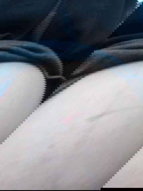 Bahayakah terjepret karet