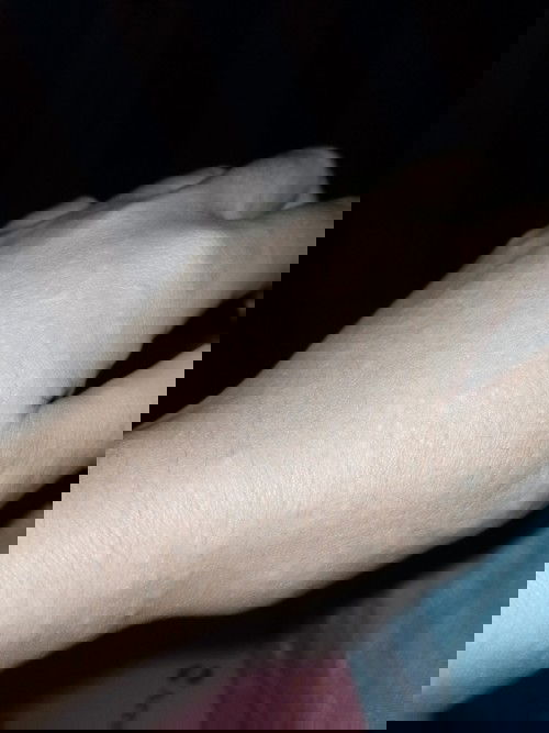 Gatal gatal lagi hamil