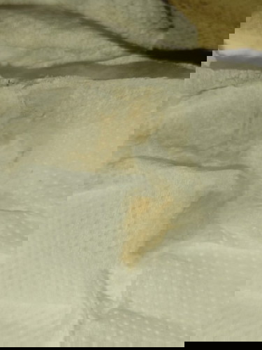 ADVICE PO. BROWN DISCHARGE AT 8 WEEKS