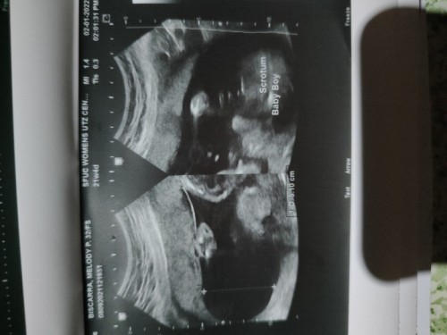 My ultrasound. IT'S A BABY BOY‼️🤗