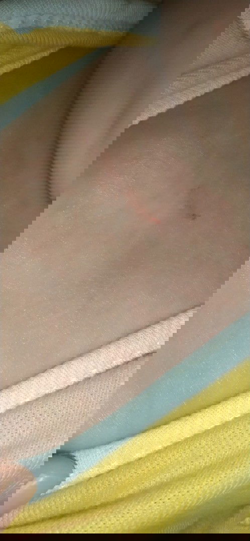 Gatal gatal bayi 6 bulan