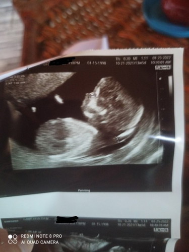 My bundle of joy