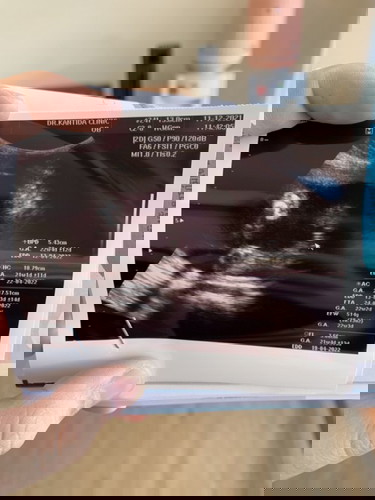 แม่ๆคิดว่าน้องเป็นผชหรือผญคะ