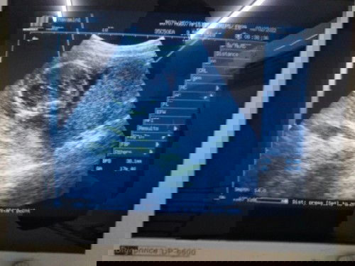 หมอบอกได้ผญ.ชัวมั้ยคะ?