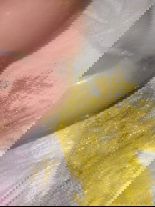 อุจจาระ ทารกอายุ1ด.9ว.