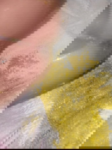 อุจจาระ ทารกอายุ1ด.9ว.