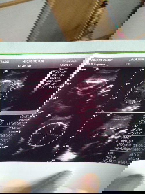 Numpang nanya iya bun