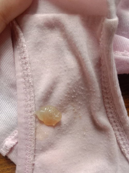 Helo oo ask ko lanh po kung mocus plug po b to or implantation bleding?4weeks pregnant plng po salam