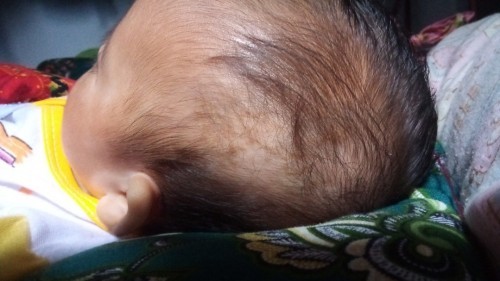 Rmbut bayi ggur