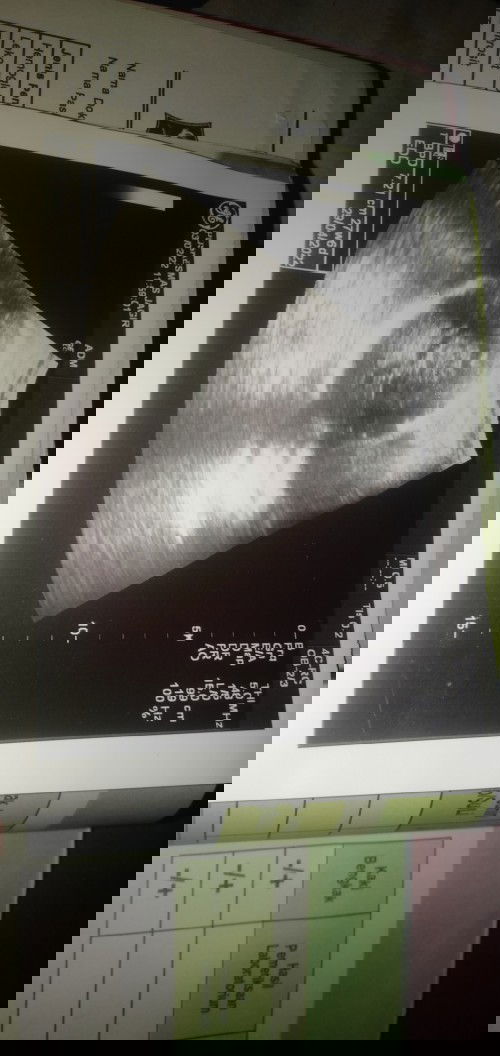 Usg 2D tolong yang tau bisa bantu jelaskan bund