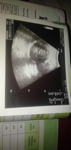 Usg 2D tolong yang tau bisa bantu jelaskan bund