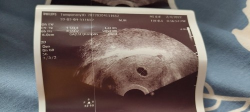 Can any one face like this situation  ?