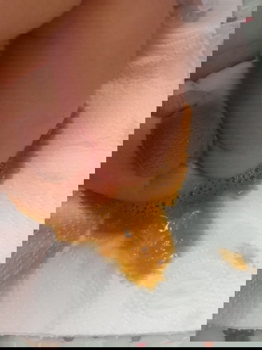 น้องถ่ายเหลว