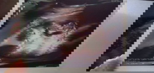 Penantian stelah 1x bo