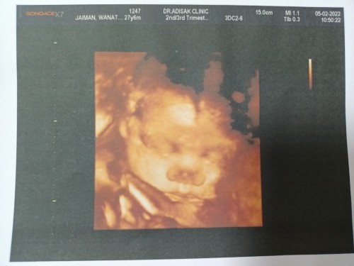 ขอคำแนะนำคะ