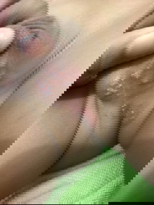 Bun anakku tiba tiba lubang anusnya merah dan bintik2 putih gitu dikasi apa ya bun biar sembuh kasian:( terimakasi bun