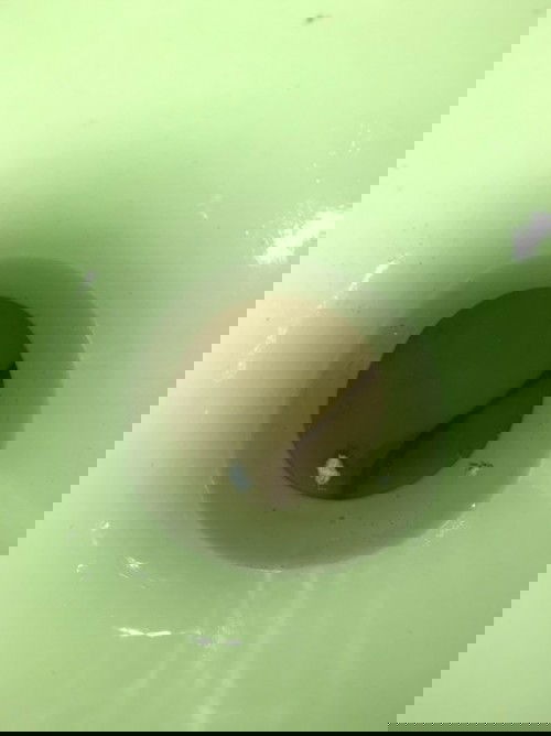 ฉี่แล้วมีแบบนี้ออกมา ปกติมั้ยคะ 36+2w ค่ะ
#ท้องแรกค่ะ