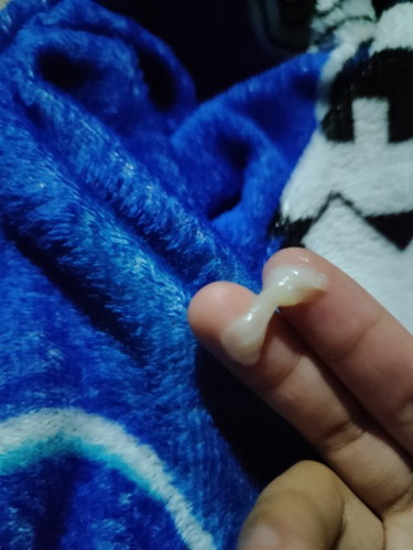 White discharge