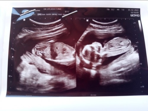 ภาพ ซ้ายมือ ค่ะดูเพศ