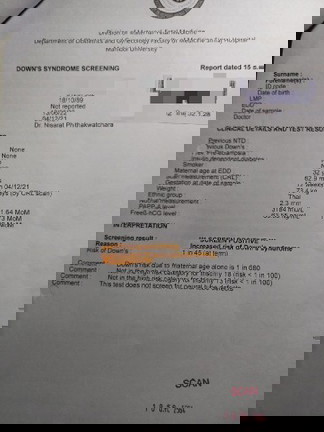 ตรวจดาวน์ซินโครมได้ผล1:45