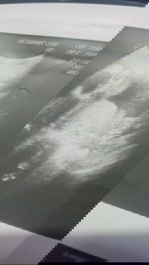 ดูออกไหมคะว่า ผญ หรือว่า ผช